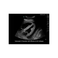 Load image into Gallery viewer, CAE Blue Phantom™ Heart Block Model - American Hospital Supply
