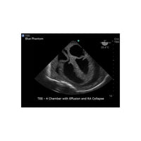 Load image into Gallery viewer, CAE Blue Phantom™ Heart Block Model - American Hospital Supply
