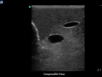 Load image into Gallery viewer, CAE Blue Phantom Internal Jugular Ultrasound Central Line Training Block - American Hospital Supply
