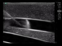 Load image into Gallery viewer, CAE Blue Phantom Internal Jugular Ultrasound Central Line Training Block - American Hospital Supply
