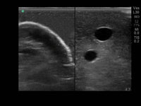 Load image into Gallery viewer, CAE Blue Phantom Internal Jugular Ultrasound Central Line Training Block - American Hospital Supply
