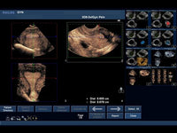 Load image into Gallery viewer, CAE Blue Phantom Pregnancy Transvaginal Ultrasound Training Model - American Hospital Supply
