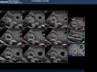 Load image into Gallery viewer, CAE Blue Phantom Pregnancy Transvaginal Ultrasound Training Model - American Hospital Supply

