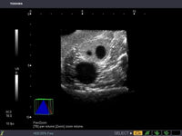 Load image into Gallery viewer, CAE Blue Phantom Pregnancy Transvaginal Ultrasound Training Model - American Hospital Supply

