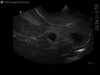 Load image into Gallery viewer, CAE Blue Phantom Pregnancy Transvaginal Ultrasound Training Model - American Hospital Supply
