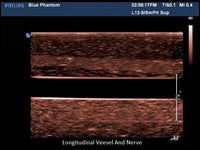 Load image into Gallery viewer, CAE Blue Phantom Regional Anesthesia Ultrasound Training Block - American Hospital Supply
