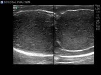 Load image into Gallery viewer, CAE Blue Phantom Scrotal Ultrasound Training Model - American Hospital Supply
