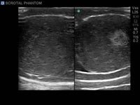Load image into Gallery viewer, CAE Blue Phantom Scrotal Ultrasound Training Model - American Hospital Supply

