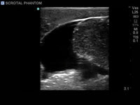 Load image into Gallery viewer, CAE Blue Phantom Scrotal Ultrasound Training Model - American Hospital Supply
