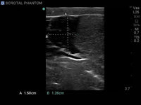Load image into Gallery viewer, CAE Blue Phantom Scrotal Ultrasound Training Model - American Hospital Supply
