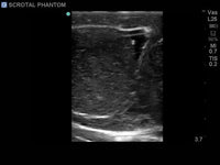 Load image into Gallery viewer, CAE Blue Phantom Scrotal Ultrasound Training Model - American Hospital Supply
