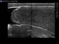 Load image into Gallery viewer, CAE Blue Phantom Scrotal Ultrasound Training Model - American Hospital Supply
