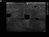 Load image into Gallery viewer, CAE Blue Phantom Select Series Ultrasound Branched 4-Vessel Training Block - American Hospital Supply
