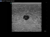 Load image into Gallery viewer, CAE Blue Phantom Soft Tissue Biopsy Training Model - American Hospital Supply
