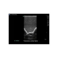 Load image into Gallery viewer, CAE Blue Phantom Upper Torso Ultrasound Training Model - American Hospital Supply
