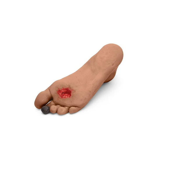 CAE Medicor Diabetic Foot Trainer - American Hospital Supply
