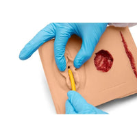 Load image into Gallery viewer, CAE Medicor MultiPad 2 Trainer Model with Urinary Catheterization &amp; Sinus Wound - American Hospital Supply
