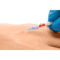 Load image into Gallery viewer, CAE Medicor Peripheral Intravenous (IV) Catheterization Hand Trainer Model - American Hospital Supply
