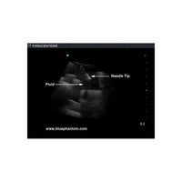 Load image into Gallery viewer, Paracentesis Ultrasound Training Model - American Hospital Supply
