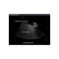 Load image into Gallery viewer, Paracentesis Ultrasound Training Model - American Hospital Supply
