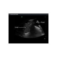 Load image into Gallery viewer, Paracentesis Ultrasound Training Model - American Hospital Supply
