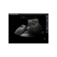 Load image into Gallery viewer, Paracentesis Ultrasound Training Model - American Hospital Supply

