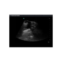 Load image into Gallery viewer, Paracentesis Ultrasound Training Model - American Hospital Supply
