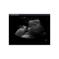 Load image into Gallery viewer, Paracentesis Ultrasound Training Model - American Hospital Supply
