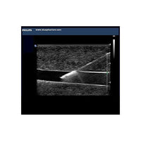 Load image into Gallery viewer, Paracentesis Ultrasound Training Model - American Hospital Supply
