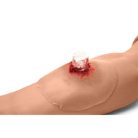 Load image into Gallery viewer, Sticky Wound Foreign Body: Bone - American Hospital Supply

