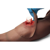 Load image into Gallery viewer, Sticky Wound Foreign Body: Bone - American Hospital Supply
