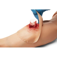 Load image into Gallery viewer, Sticky Wound Foreign Body: Bone - American Hospital Supply
