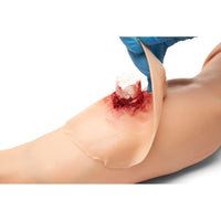 Load image into Gallery viewer, Sticky Wound Foreign Body: Bone - American Hospital Supply
