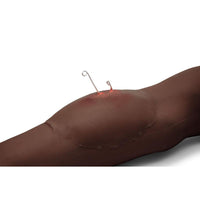 Load image into Gallery viewer, Sticky Wound Foreign Body: Fish Hook - American Hospital Supply
