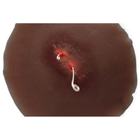 Load image into Gallery viewer, Sticky Wound Foreign Body: Fish Hook - American Hospital Supply
