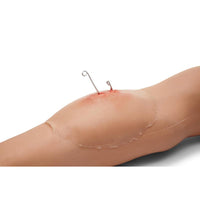 Load image into Gallery viewer, Sticky Wound Foreign Body: Fish Hook - American Hospital Supply
