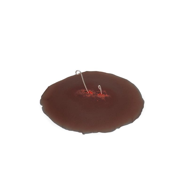 Sticky Wound Foreign Body: Fish Hook - American Hospital Supply