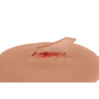 Load image into Gallery viewer, Sticky Wound Foreign Body: Glass - American Hospital Supply
