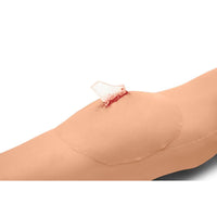 Load image into Gallery viewer, Sticky Wound Foreign Body: Glass - American Hospital Supply

