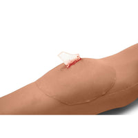 Load image into Gallery viewer, Sticky Wound Foreign Body: Glass - American Hospital Supply
