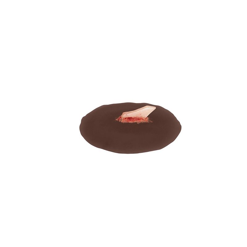Sticky Wound Foreign Body: Glass - American Hospital Supply