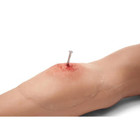 Load image into Gallery viewer, Sticky Wound Foreign Body: Nail - American Hospital Supply
