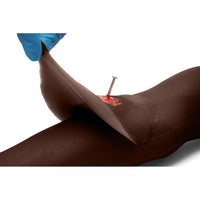 Load image into Gallery viewer, Sticky Wound Foreign Body: Nail - American Hospital Supply
